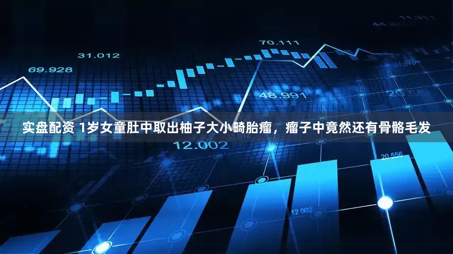 实盘配资 1岁女童肚中取出柚子大小畸胎瘤，瘤子中竟然还有骨骼毛发
